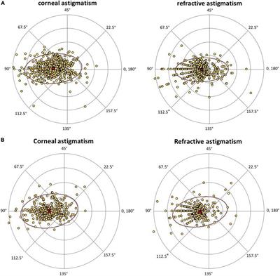 Age- and gender-related characteristics of astigmatism in a myopic population